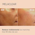Isdinceutics Melaclear 15 mL - Imagen 3